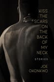 Book cover of Kiss the Scars on the Back of My Neck