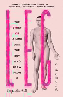 Book cover of Leg: The Story of a Limb and the Boy Who Grew from It